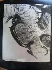 PHOTO  MEDICALE D ART SUR PLAQUE ALU Cabinet de curiosité INSERM MARSEILLE