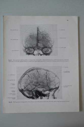 Planche anatomie humaine - planche, d'anatomie