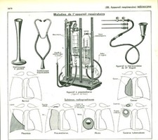 Document ancien médecine maladies de l'appareil respiratoire issu  livre de 1953