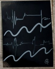 Dessin original Electrocardiogramme plat carton noir fort Posca  blanc signé