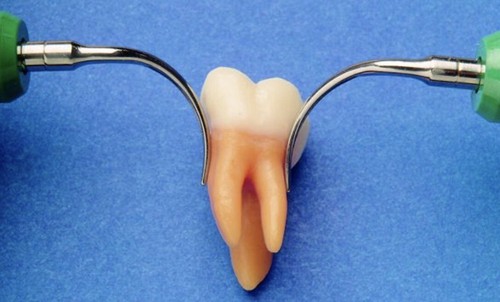 Cavitron 25k insert - cavitron,
