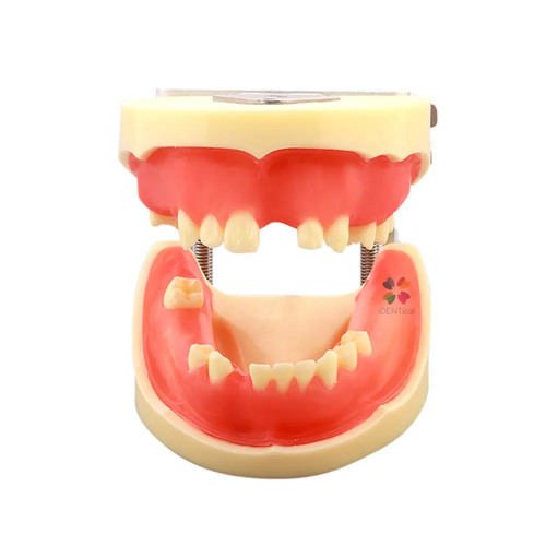Modèle pratique implant - modèle,