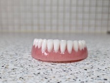 Prothèse inférieure