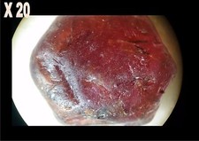 1 Rubis rouge brut de