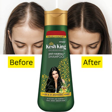 Shampooing antichute pour le cuir chevelu Kesh King 21 herbes ayurvédiques - ...