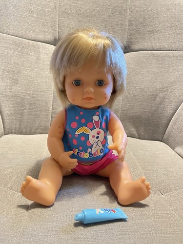 Cicciobello morbillino measles - cicciobello,