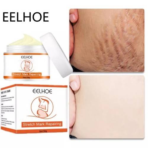 Creme vergeture élimination - ,