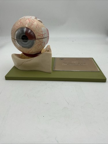 Somso cs1 eyeball enlarged - eyeball,
