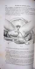 °GYNECOLOGIE XIX° Bel ex.-