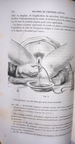 Gynecologie xix bel - °gynecologie, ex.-
