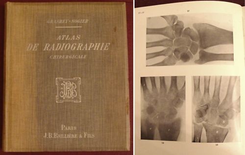 Grashey atlas radiographie - grashey., de