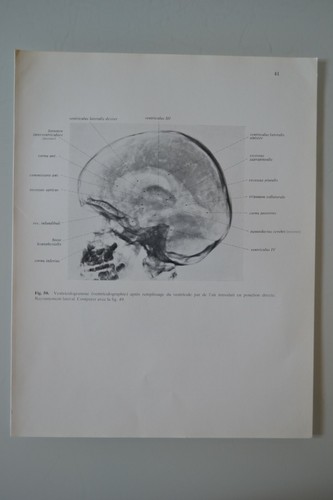 Planche anatomie humaine - planche, d'anatomie