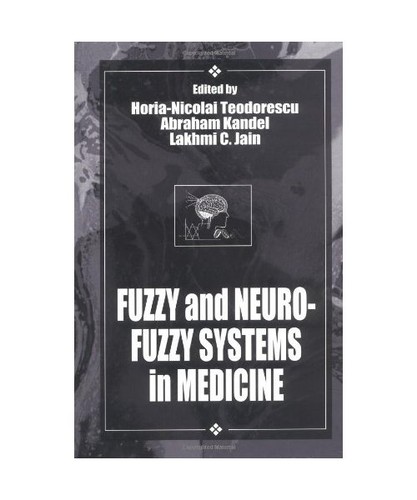 Fuzzy and neuro systems - and, neuro-fuzzy