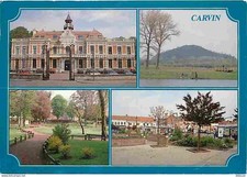 62 - Carvin - Multivues - CPM - Voir Scans Recto-Verso