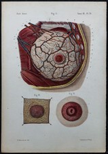 1866 - Glande mammaire
