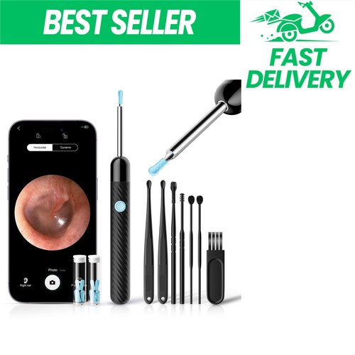 Otoscope oreille 1080p - hd,