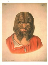 Cabinet de curiosité planche affiche A3 médicale portrait d'homme très poilus 