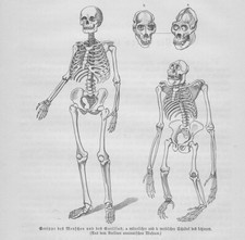 Squelette Humain - Gravure Sur