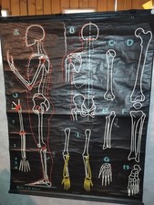 CARTE SCOLAIRE DR AUZOUX  - SQUELLETTE/OS BRAS ET JAMBE - P SOUGY  - 100X130 CM