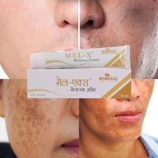 Wheezal Mel-X Melasma Cream