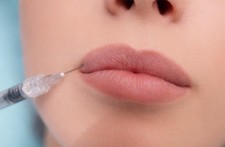 Botox