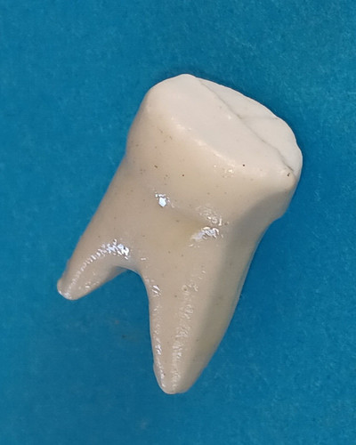 Feve rare 1ère époque dent - feve,