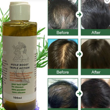 L’Huile Croissance extrême pousse Cheveux, traitement pousse Cheveux