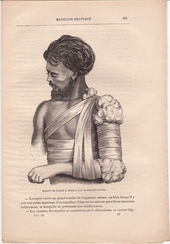 Ancienne gravure médicale - , 39-