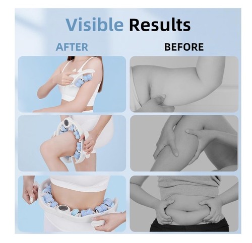 Fascia cellulite lymphatic - cellulite,