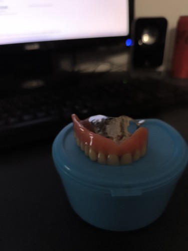 Dentier prothèse dentaire - prothèse,