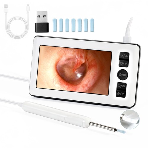 Otoscope numérique avec