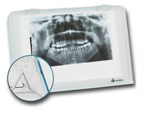 Négatoscope dentaire led pour - négatoscope,