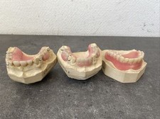 3 Anciennes Prothèses