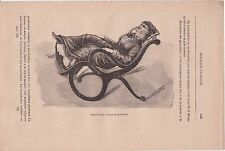 Ancienne gravure médicale 129 - Médecine pratique - Fauteuil pour examen
