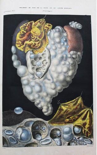 Cruveilhier jean anatomie - cruveilhier,,