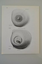 PLANCHE D'ANATOMIE HUMAINE LA PEAU ATLAS Dr SOBOTTA MEDECINE SCIENCE