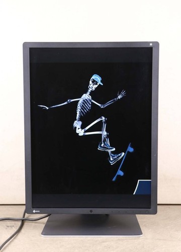 Moniteur médical eizo - médical,