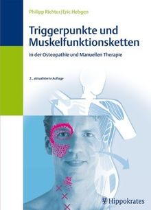 Triggerpunkte und