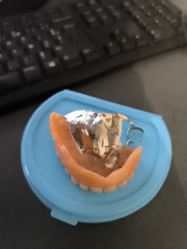 Dentier Prothèse Dentaire