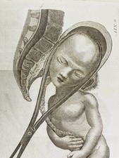 Obstétrique 1807 Gynécologue