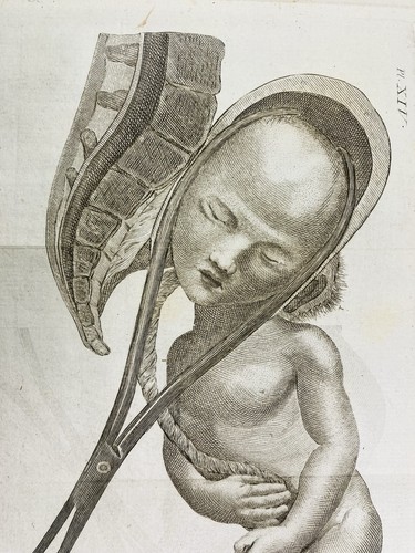 Obstétrique 1807 gynécologue - obstétrique,