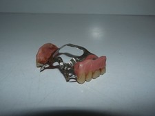 Ancien dentier prothèse