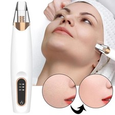 Aspirateur électrique pour points noirs et pores du visage A7T1