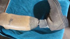 ANCIENNE PROTHESE DE JAMBE