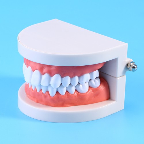 Modèle dents étude la - de,
