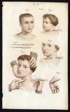 Cabinet de curiosité planche affiche A3 anatomie humaine chirurgie n°30 enfants