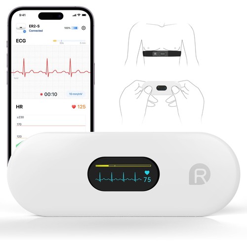 Appareil ecg checkme er2 - ecg,