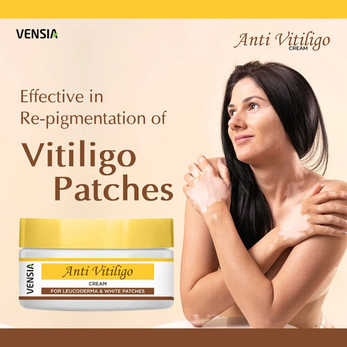 Vensia anti vitiligo cream - cream, |