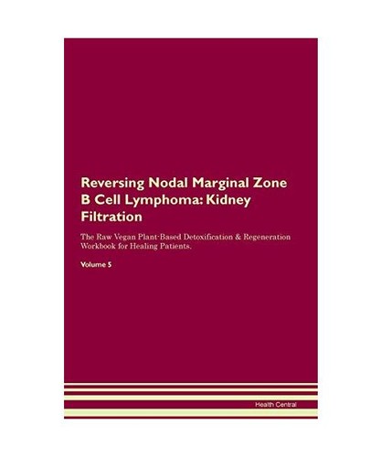 Reversing nodal marginal - reversing,