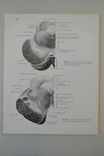 Planche anatomie humaine - planche,